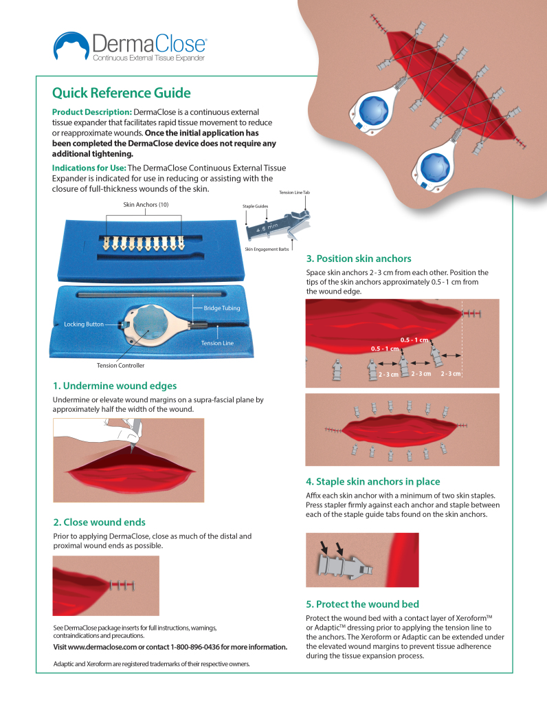 Instructional Guides Continuous External Tissue Expander