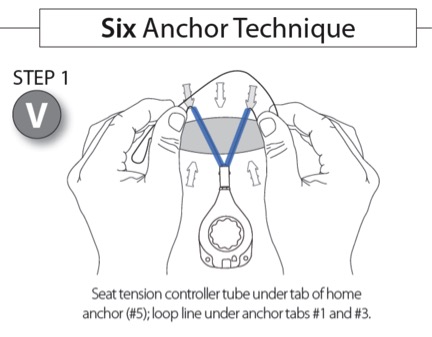 Wound Closure Techniques