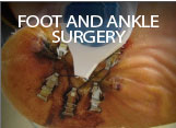 Foot and Ankle